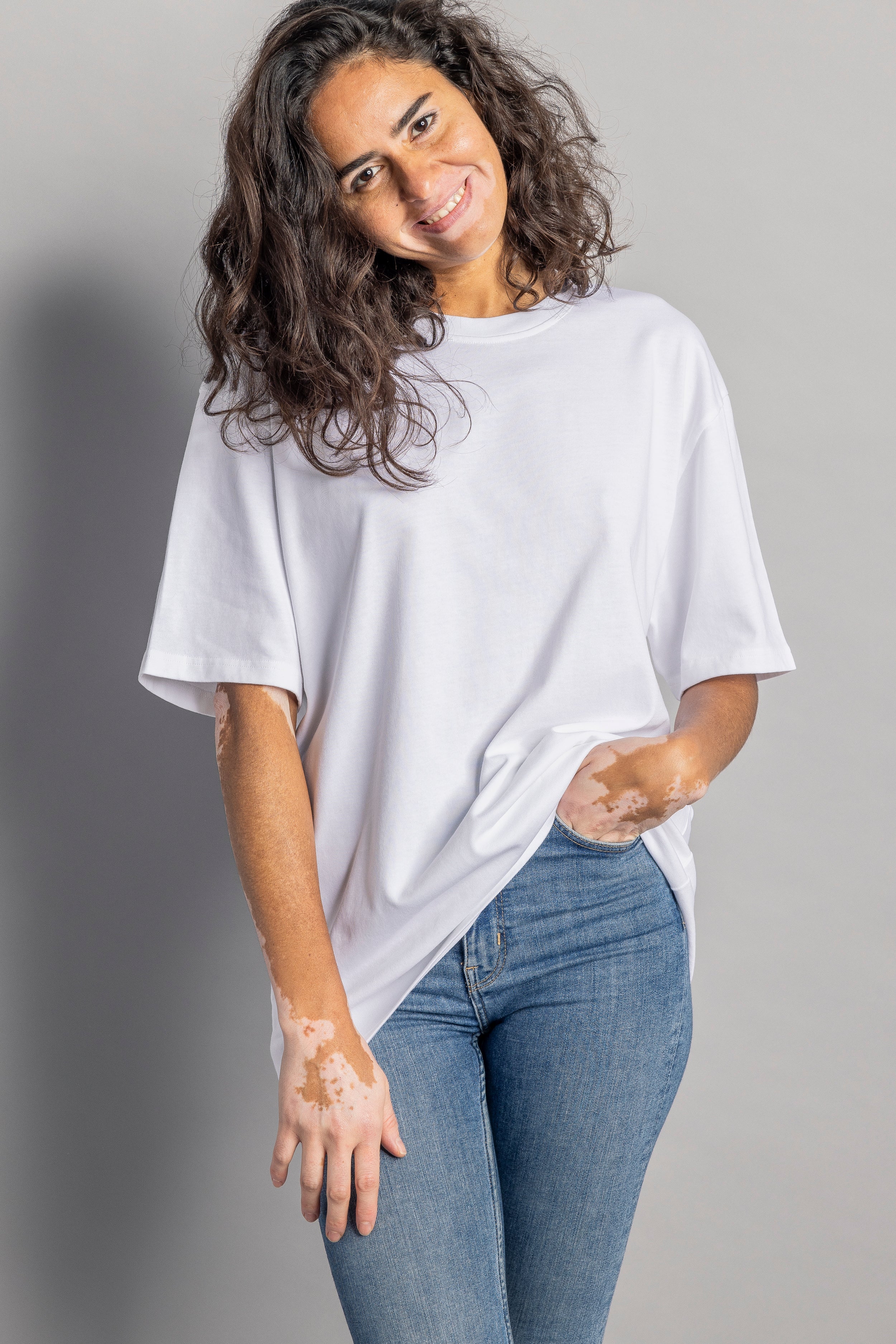 White